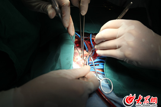 9:28������ǻ���İ���ǻ��ע��мˮ��ʹ���K����